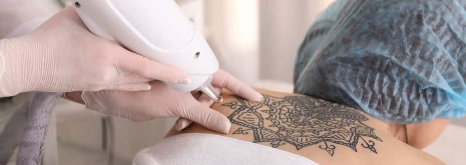 Razones médica para la eliminación de tatuajes
